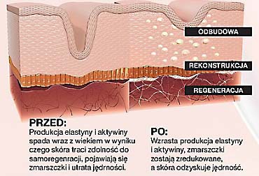 technologia tri-elastinex